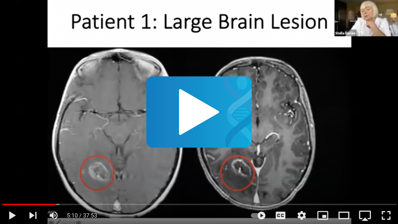 Neuroinflammation Issues in Adults with Fanconi Anemia - Fanconi Cancer ...